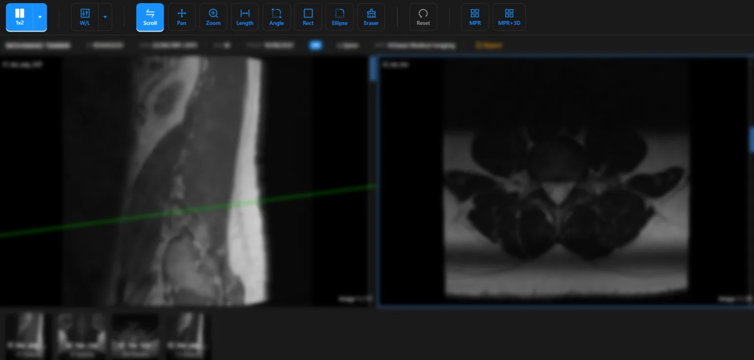 Envision RIS web DICOM viewer