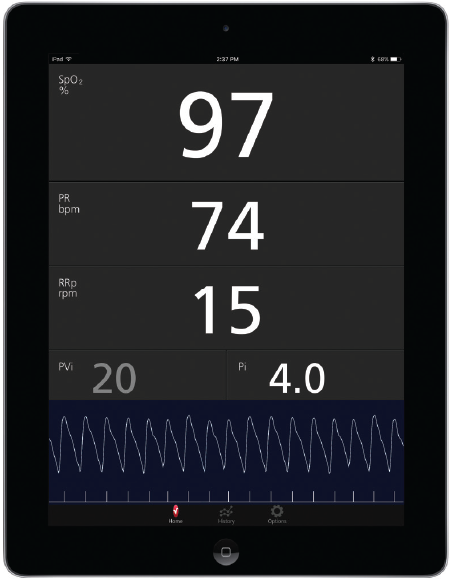SpO2, pulse rate and perfusion index from MightySat Rx in the Masimo Professional Health app