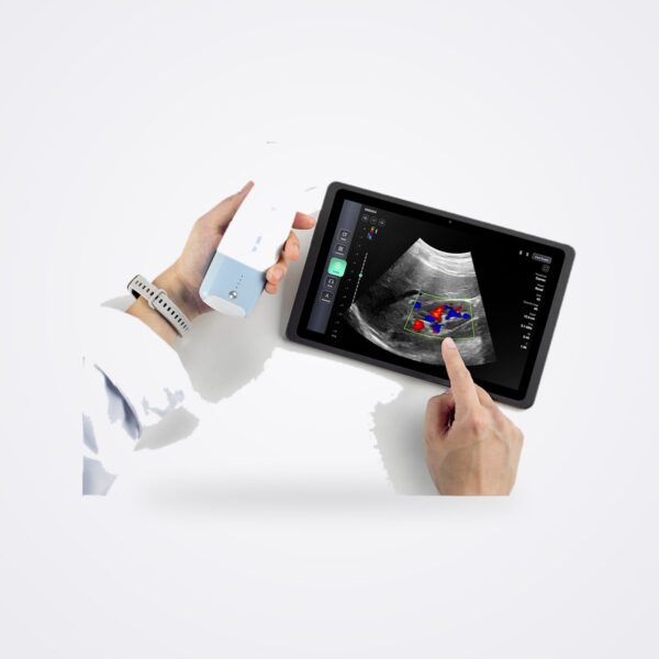 Clinician holding an ASUS LU800 probe beside a tablet showing a colour Doppler ultrasound image