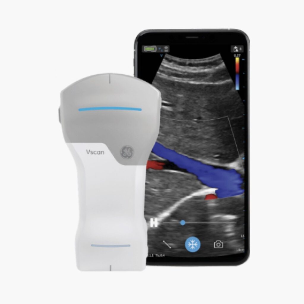 GE Vscan Air CL probe with live colour Doppler image on a smartphone