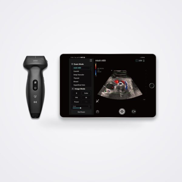Mindray TE Air e5M wireless probe beside a tablet showing an abdominal colour Doppler scan in the TE Air app