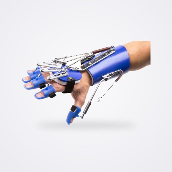 Rehabilitation & Recovery 13 SaeboFlex dynamic hand orthosis on a forearm, showing digit caps, springs and outrigger