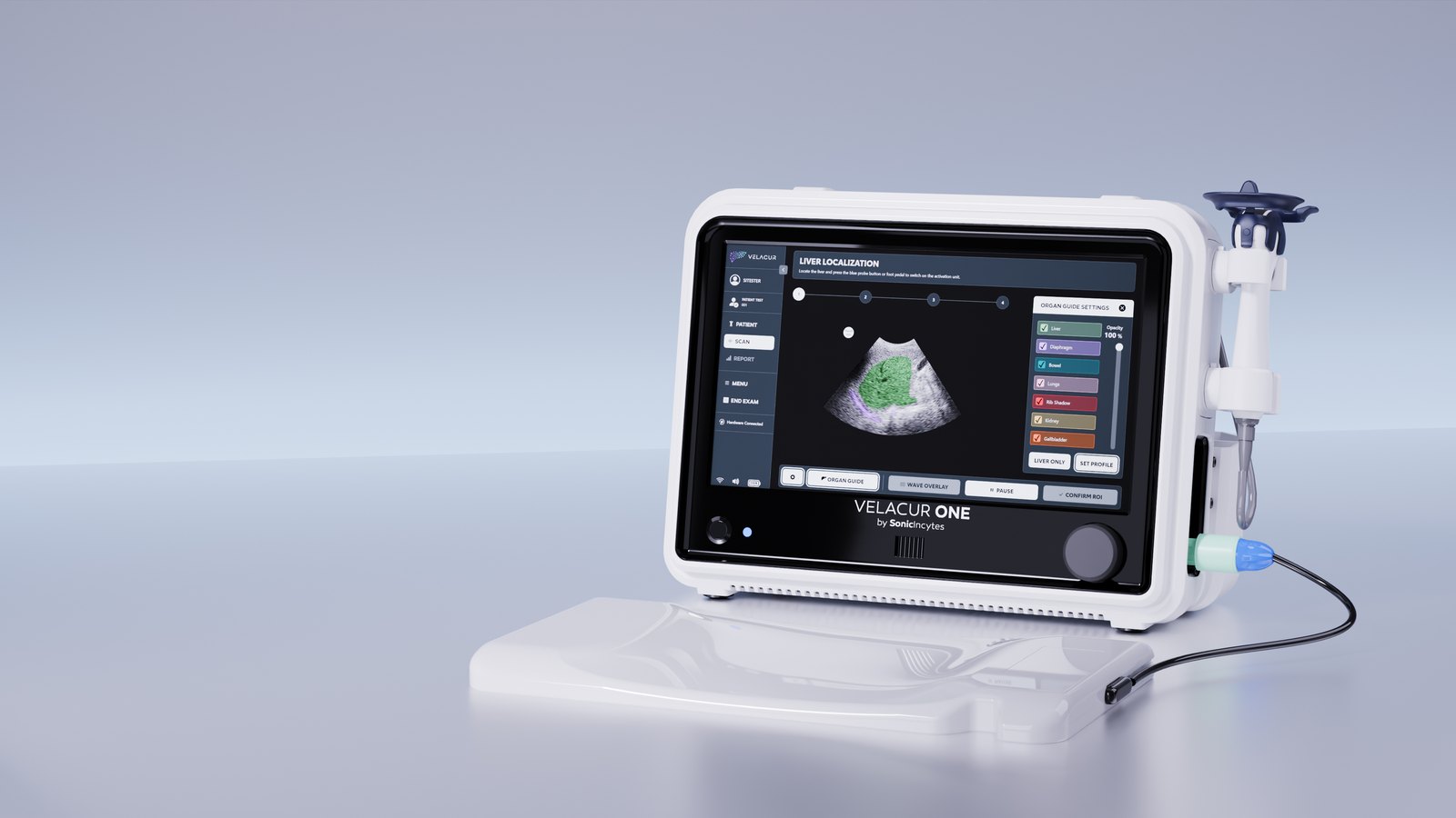 Sonic Incytes Velacur ONE AI-Guided Liver Ultrasound Elastography 3 Velacur ONE console on its activation pad showing a liver B mode image