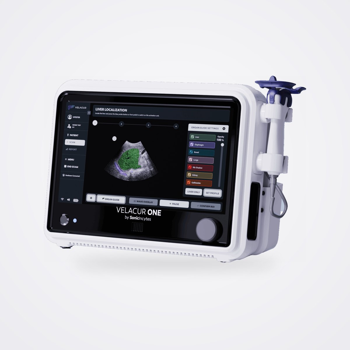Sonic Incytes Velacur ONE AI-Guided Liver Ultrasound Elastography 1 Sonic Incytes Velacur ONE elastography system with touchscreen and holstered probe
