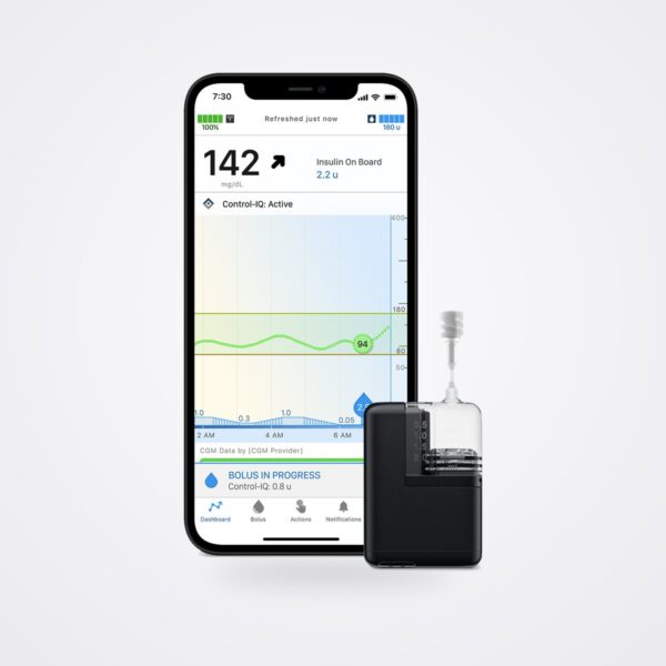 مضخة الإنسولين Tandem Mobi بجانب هاتف ذكي يعرض لوحة تطبيق Tandem Mobi مع منحنى الغلوكوز من جهاز CGM