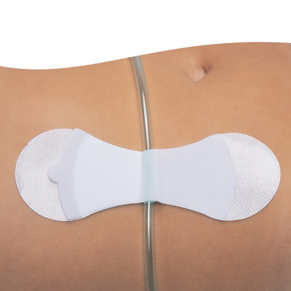 TIDI Grip-Lok Universal Catheter and Tube Securement Devices 3 Grip Lok large universal device securing a drainage tube to the abdomen